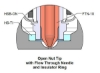 Picture of HS-TI